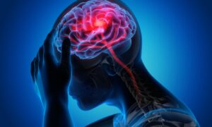 yoga for migraines